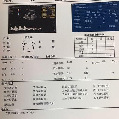 《QQ炫舞手游ACPW介绍攻略》（掌握ACPW技巧）